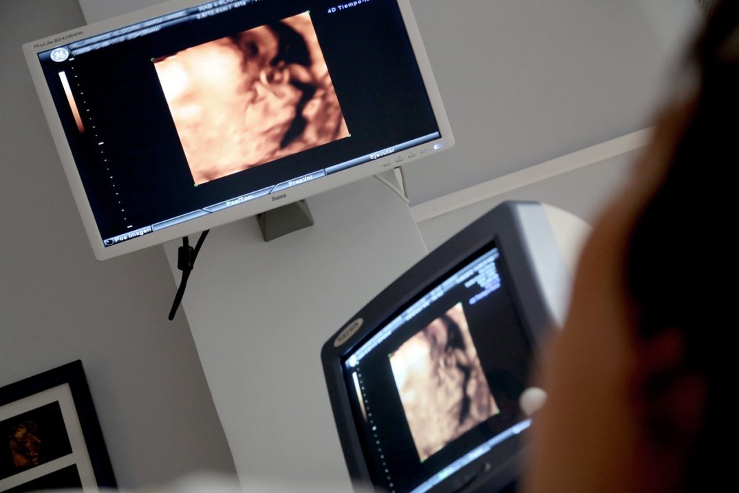 A woman viewing an ultrasound