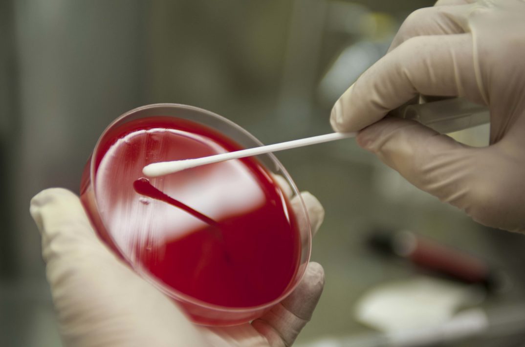 Image of a scientist swabbing a petri dish.