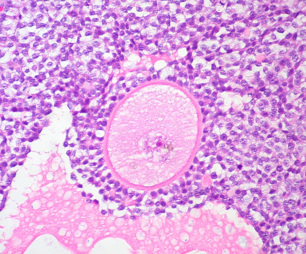 image of ovarian follicles