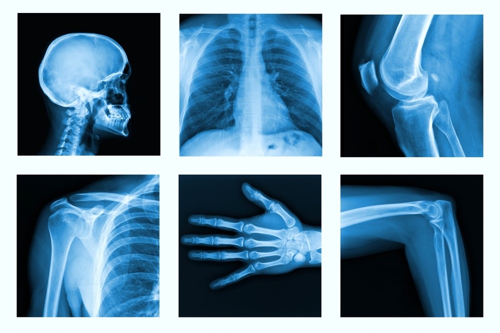 image of human x-ray collage