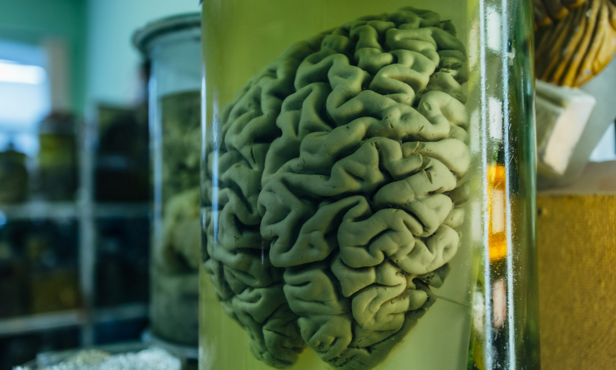 photograph of human brains in glass jars with formaldehyde