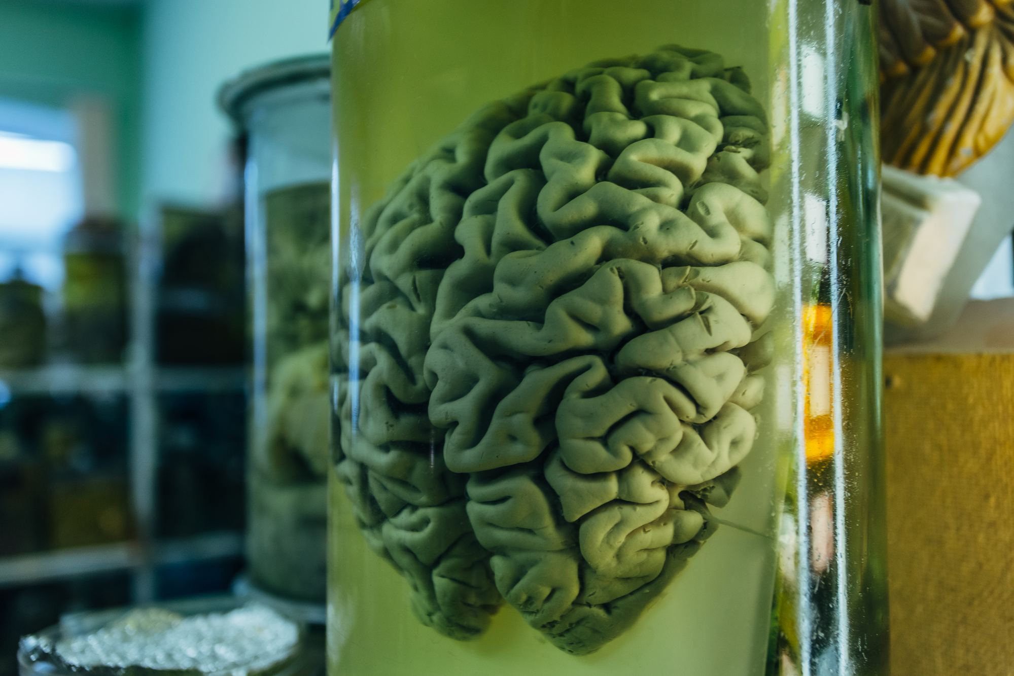 photograph of human brains in glass jars with formaldehyde