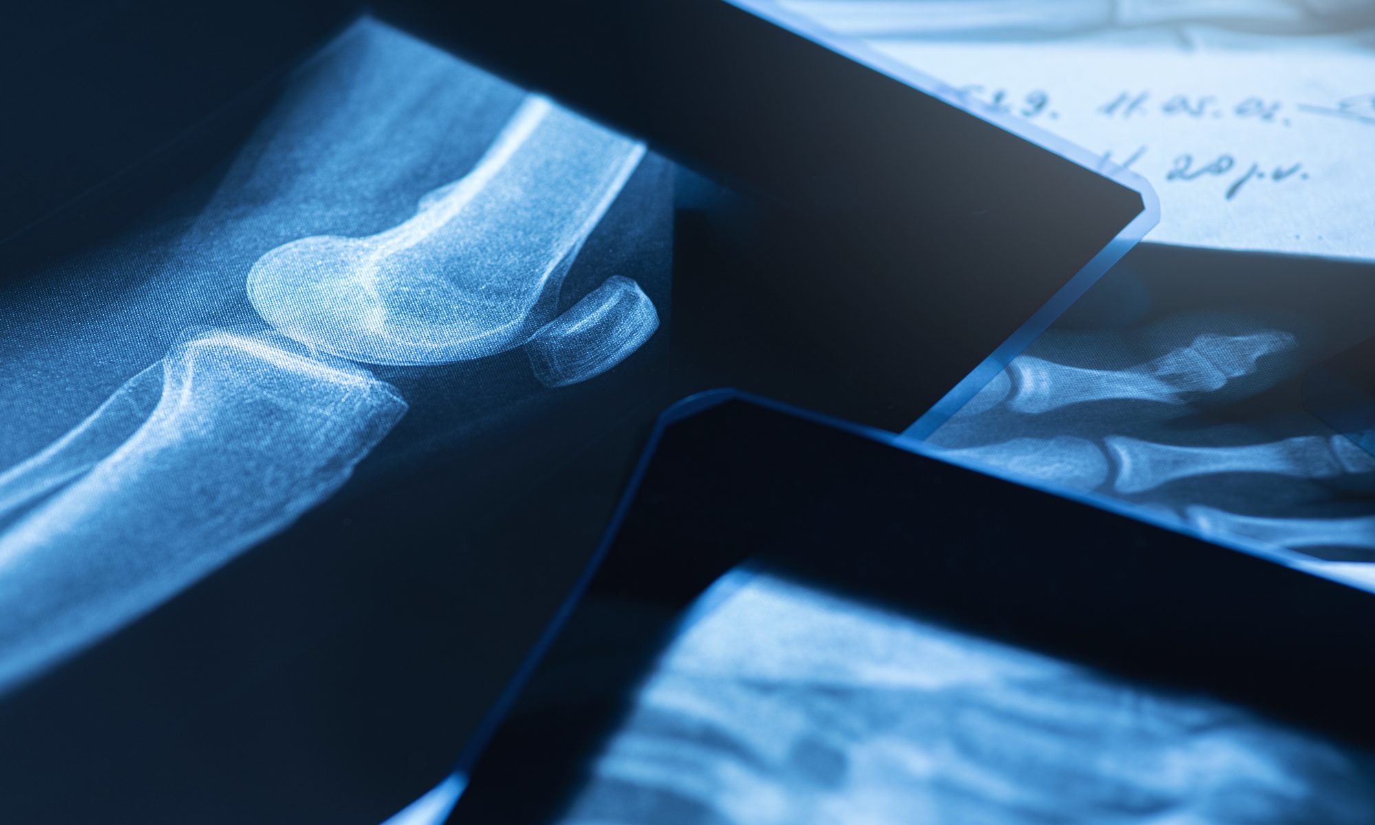 image of xrays of multiple body parts