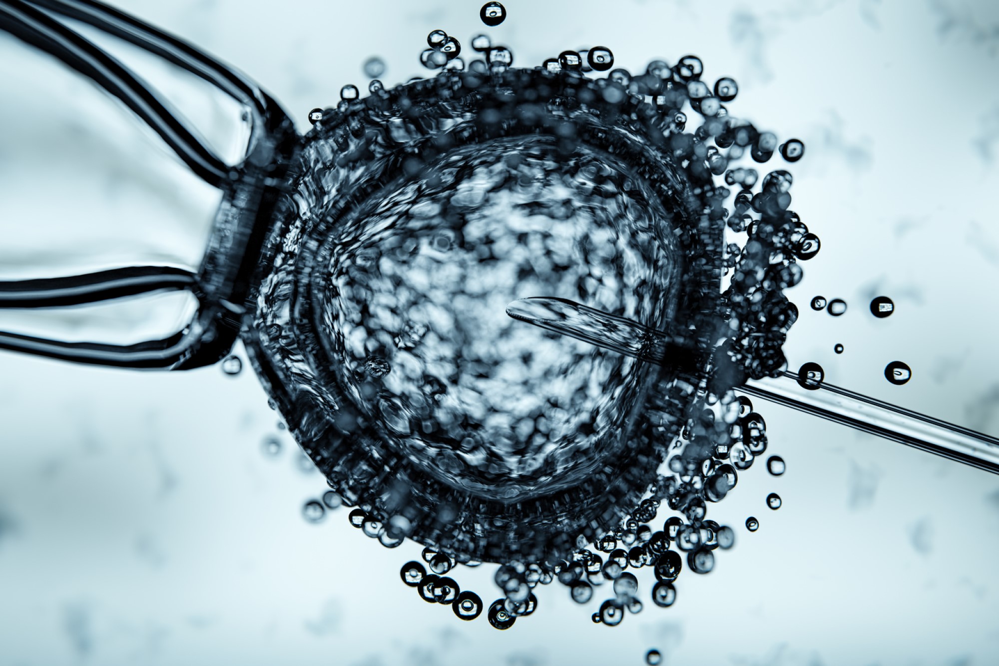 image of in vitro fertilization